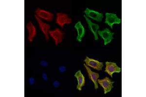 ABIN6265062 and ABIN6269205 staining Hela cells by IF/ICC.