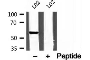 Western blot analysis of extracts of L02 cells, using CYP26B1 antibody. (CYP26B1 抗体  (Internal Region))
