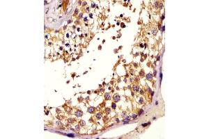 (ABIN6243764 and ABIN6578200) staining KISS1 in human testis tissue sections by Immunohistochemistry (IHC-P - paraformaldehyde-fixed, paraffin-embedded sections). (KISS1 抗体  (AA 20-52))