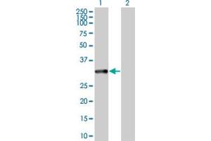 Western Blotting (WB) image for anti-Microtubule-Associated Protein, RP/EB Family, Member 1 (MAPRE1) (AA 1-268) antibody (ABIN524854)