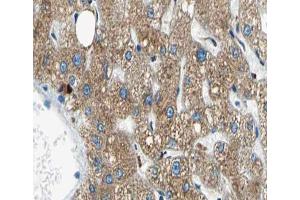 ABIN6266653 at 1/100 staining human liver tissue sections by IHC-P. (NUB1 抗体)