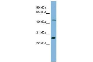 UPB1 antibody used at 1 ug/ml to detect target protein. (UPB1 抗体  (Middle Region))