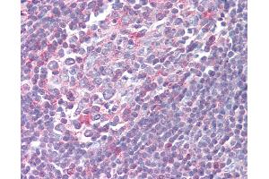 Anti-XCR1 antibody IHC of human tonsil. (XCR1 抗体  (Cytoplasmic Domain))