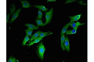 Immunofluorescent analysis of Hela cells using ABIN7172344 at dilution of 1:100 and Alexa Fluor 488-congugated AffiniPure Goat Anti-Rabbit IgG(H+L) (TRAF3IP3 抗体  (AA 74-185))