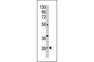 The CA9 polyclonal antibody  is used in Western blot to detect CA9 in Jurkat cell lysate. (CA9 抗体  (N-Term))