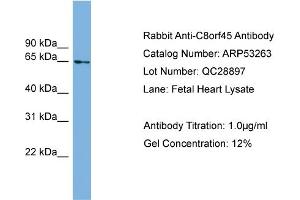 WB Suggested Anti-C8orf45  Antibody Titration: 0. (C8orf45 抗体  (Middle Region))