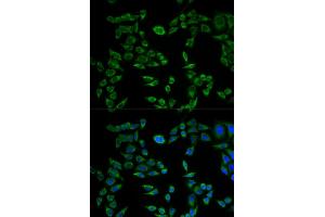 Immunofluorescence analysis of HeLa cells using VAPB antibody. (VAPB 抗体)