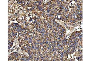 IHC analysis of HSD17B7 using anti-HSD17B7 antibody (ABIN7600174).