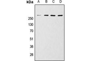 Western blot analysis of mTOR expression in HeLa (A), MCF7 (B), Jurkat (C), A431 (D) whole cell lysates. (MTOR 抗体  (C-Term))