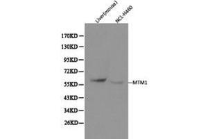 Western Blotting (WB) image for anti-Myotubularin 1 (MTM1) antibody (ABIN1873773) (MTM1 抗体)