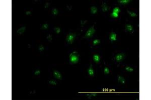 Image no. 1 for anti-Zic Family Member 4 (ZIC4) (AA 249-320) antibody (ABIN466252) (ZIC4 抗体  (AA 249-320))