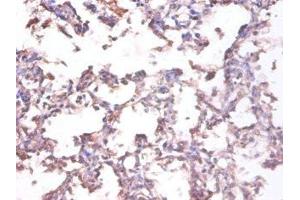 Immunohistochemistry of paraffin-embedded human lung tissue using ABIN7173786 at dilution of 1:100 (LTA 抗体  (AA 39-281))