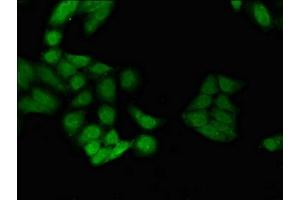 Immunofluorescence (IF) image for anti-Inhibitor of DNA Binding 4, Dominant Negative Helix-Loop-Helix Protein (ID4) (AA 1-161) antibody (ABIN7150376)