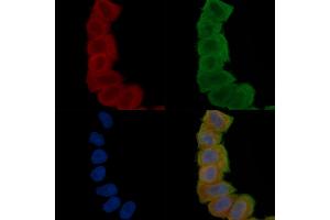 ABIN6265833 and ABIN6277102 staining Hela cells(30 min of UV treatment) by IF/ICC. (UAP1 抗体  (Internal Region))