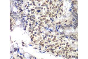 Immunohistochemistry of paraffin-embedded Rat Intestine using U2AF1 Polyclonal Antibody at dilution of 1:200 (40x lens). (U2AF1 抗体)