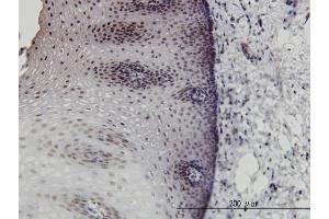 Immunoperoxidase of monoclonal antibody to DLX2 on formalin-fixed paraffin-embedded human esophagus. (DLX2 抗体  (AA 1-110))