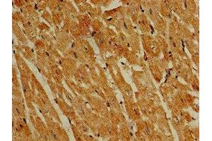 Immunohistochemistry of paraffin-embedded human heart tissue using ABIN7163291 at dilution of 1:100 (PIK3R4 抗体  (Regulatory Subunit 4))