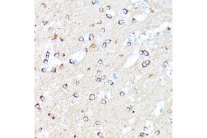 Immunohistochemistry of paraffin-embedded mouse brain using CCDC6 antibody (ABIN7266442) at dilution of 1:100 (40x lens). (CCDC6 抗体  (AA 55-222))