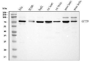 Western blot analysis of Optineurin using anti-Optineurin antibody (ABIN3042498). (OPTN 抗体  (AA 241-577))