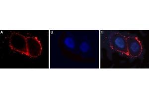 Expression of LHR in human ovary cell line - Cell surface detection of LHR in intact living OVCAR3 cells.