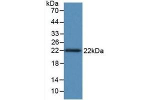 Detection of Recombinant TNFb, Human using Monoclonal Antibody to Tumor Necrosis Factor Beta (TNFb) (LTA 抗体  (AA 36-205))