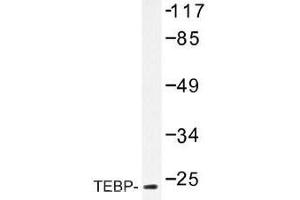 Image no. 2 for anti-Prostaglandin E Synthase 3 (Cytosolic) (PTGES3) antibody (ABIN317783) (PTGES3 抗体)