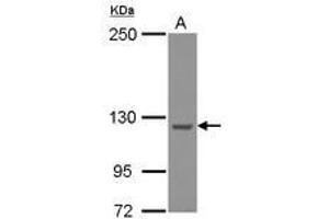 Image no. 2 for anti-WASH Complex Subunit 5 (WASHC5) (C-Term) antibody (ABIN1491792) (Strumpellin 抗体  (C-Term))