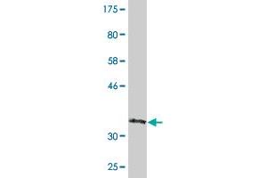 Western Blot detection against Immunogen (36. (CRYBB3 抗体  (AA 112-211))