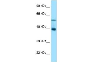 WB Suggested Anti-Trim7 Antibody Titration: 1. (TRIM7 抗体  (N-Term))