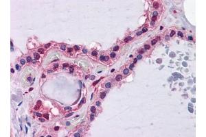 Immunohistochemistry (IHC) image for anti-Hepcidin Antimicrobial Peptide (HAMP) (AA 25-85) antibody (ABIN614727) (Hepcidin 抗体  (AA 25-85))