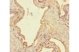 Immunohistochemistry (IHC) image for anti-Ubiquitin Specific Peptidase 14 (USP14) (AA 1-494), (C-Term) antibody (ABIN7174258)