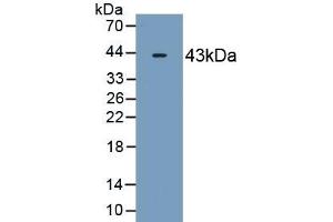 Detection of Recombinant OAS2, Human using Monoclonal Antibody to 2',5'-Oligoadenylate Synthetase 2 (OAS2) (OAS2 抗体  (AA 11-346))