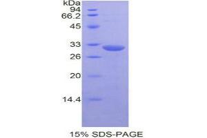 SDS-PAGE analysis of Mouse MAPK8 Protein. (JNK 蛋白)