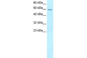 WB Suggested Anti-FOXG1A Antibody Titration:  5. (FOXG1 抗体  (N-Term))