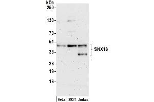 Western Blotting (WB) image for anti-Sorting Nexin 16 (SNX16) (AA 250-300) antibody (ABIN7452632)