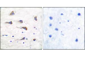 Immunohistochemical analysis of paraffin-embedded human brain tissue using GluR6 antibody. (Metabotropic Glutamate Receptor 6 抗体)