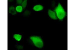 Detection of ENO3 in Hela cells using Polyclonal Antibody to Enolase 3 (ENO3) (ENO3 抗体  (AA 1-391))