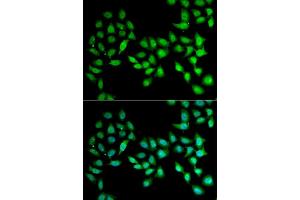 Immunofluorescence analysis of U2OS cells using UCN2 antibody (ABIN5973879). (Urocortin 2 抗体)