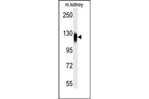 Image no. 1 for anti-Histone Deacetylase 6 (HDAC6) (C-Term) antibody (ABIN356649) (HDAC6 抗体  (C-Term))