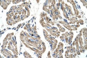Image no. 1 for anti-Solute Carrier Family 25, Member 38 (SLC25A38) (AA 101-150) antibody (ABIN6736660) (SLC25A38 抗体  (AA 101-150))