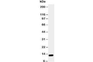 Western blot testing of TFF1 antibody and rat stomach tissue lysate (TFF1 抗体  (Middle Region))