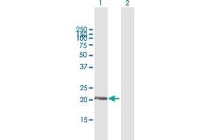 Western Blot analysis of DUSP18 expression in transfected 293T cell line by DUSP18 MaxPab polyclonal antibody. (DUSP18 抗体  (AA 1-188))