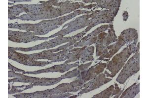 IHC analysis of NRF1 using anti-NRF1 antibody (ABIN6719347).