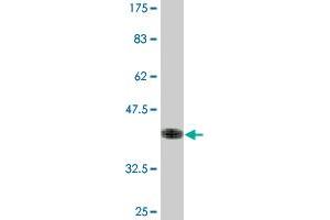 Western Blotting (WB) image for anti-Signal Sequence Receptor, beta (Translocon-Associated Protein Beta) (SSR2) (AA 51-150) antibody (ABIN520506)