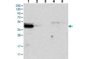 Western blot analysis of Lane 1: RT-4, Lane 2: U-251 MG, Lane 3: Human Plasma, Lane 4: Liver, Lane 5: Tonsil with C9orf41 polyclonal antibody  at 1:250-1:500 dilution. (C9orf41 抗体)