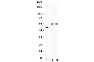 Western blot testing of CYP2E1 antibody and Lane 1:  rat liver;  2: human HeLa;  3: (h) Jurkat;  Observed size: 56-65KD (CYP2E1 抗体  (AA 1-310))
