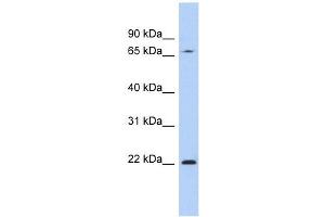 RPS7 antibody used at 1 ug/ml to detect target protein. (RPS7 抗体  (N-Term))