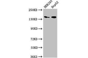 Western Blot Positive WB detected in: HEK293 whole cell lysate, HepG2 whole cell lysate All lanes: MAN2A1 antibody at 3. (alpha-Mannosidase II 抗体  (AA 31-181))