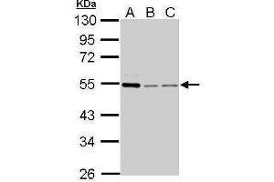 WB Image Cyclin A2 antibody detects CCNA2 protein by Western blot analysis.