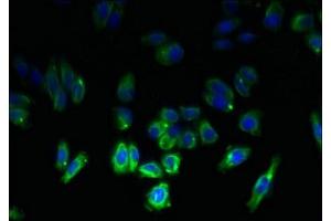 Immunofluorescent analysis of HepG2 cells using ABIN7171883 at dilution of 1:100 and Alexa Fluor 488-congugated AffiniPure Goat Anti-Rabbit IgG(H+L) (Tetraspanin 6 抗体  (AA 115-208))
